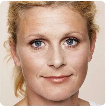 Женщина до применения маски для лица Platinum Mask.